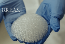 Conexeu Sciences advances 3D Biofabricated Matrix to move breast reconstruction beyond implants Conexeu Sciences advances 3D Biofabricated Matrix to move breast reconstruction beyond implants